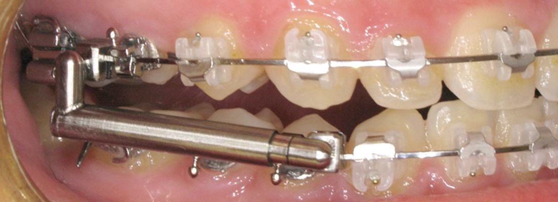 Non-Compliance-Geräte